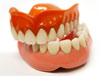 שתלים לשיניים כפתרון לשיניים חסרות